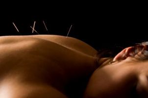 akupunkturiste praha Susan Ondrasek Acupuncture / Seven Treasures Healing Arts