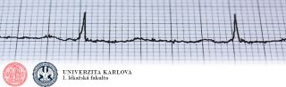 leka i v eobecna a za ivaci chirurgie praha II. interní klinika - klinika kardiologie a angiologie 1. LF UK a VFN v Praze